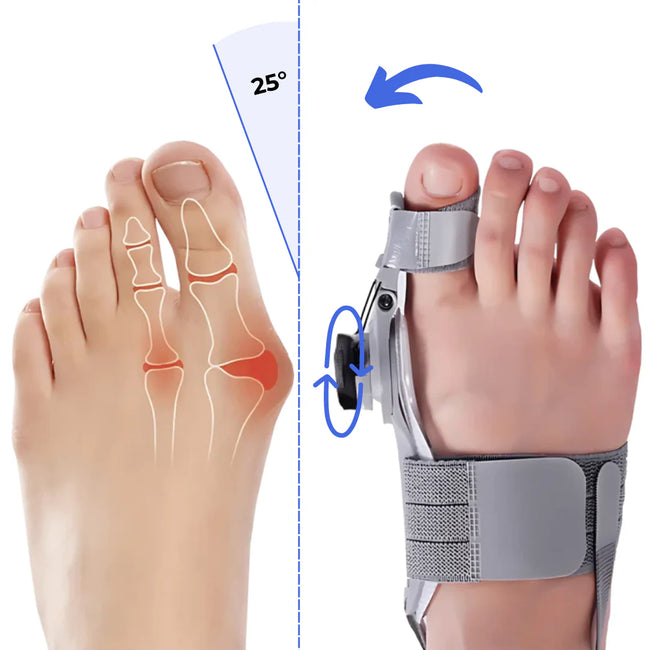 AlignStep ComfortFix