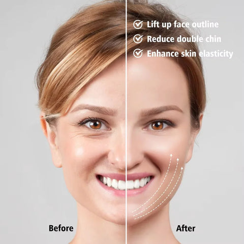 RadiantLift Face Massager
